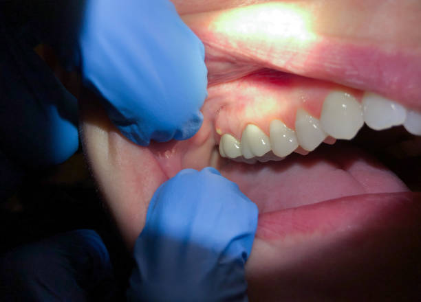 Best Urgent Dental Care in Marshall, VA