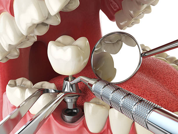 Best Emergency Treatment for Toothache in Marshall, VA