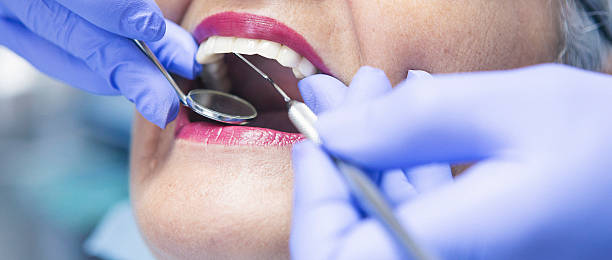 Best Emergency Root Canal Treatment in Marshall, VA